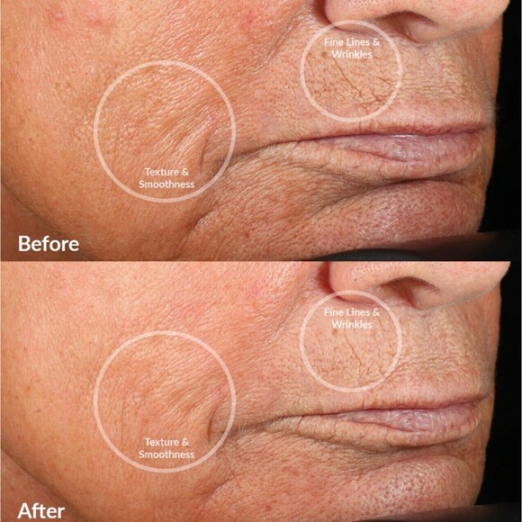 EUC Personal Microderm Classic Device Kit - PMD - Picture 4 of 14